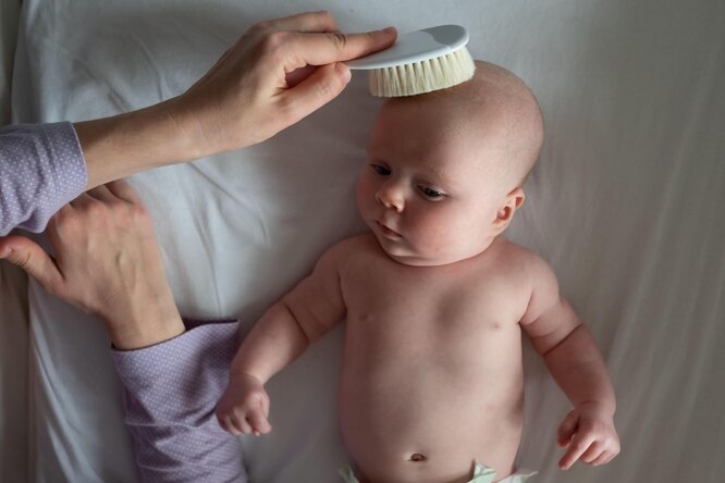 Выпадение волос у грудничка - что нужно знать родителям | Мир мам: блог педиатра | Дзен