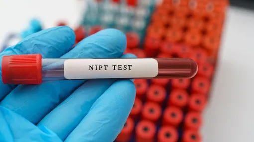 пробирка NIPT test на руке в голубой перчатке