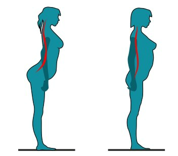 Тест: Что Вы знаете о заболевании «Боль в спине»?