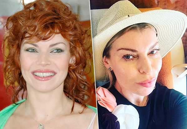 Догадаться невозможно: 9 турецких актрис-красавиц до и после пластики