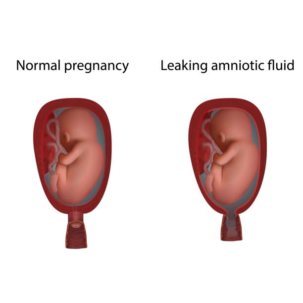 Холестаз беременных: как определить и лечить
