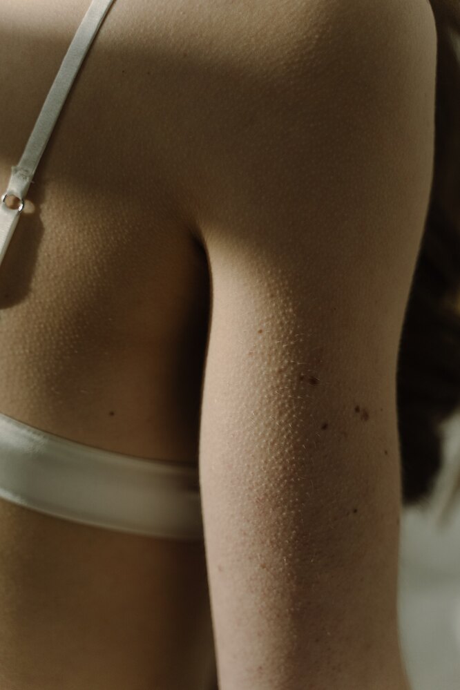 «Как будто мурашки по коже»: врач объясняет причины появления такого ощущения